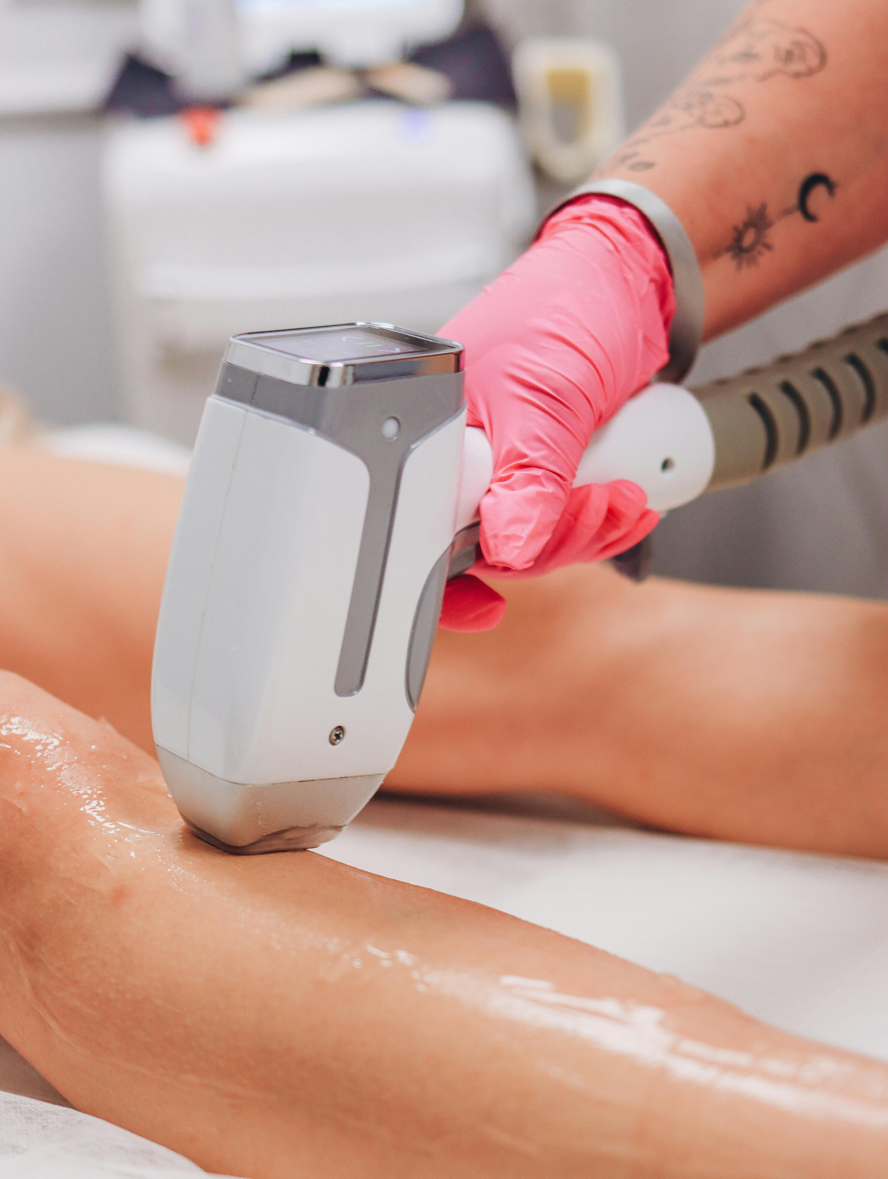 Laser Hair Removal FAQ: Everything You Need to Know Before Your First Session