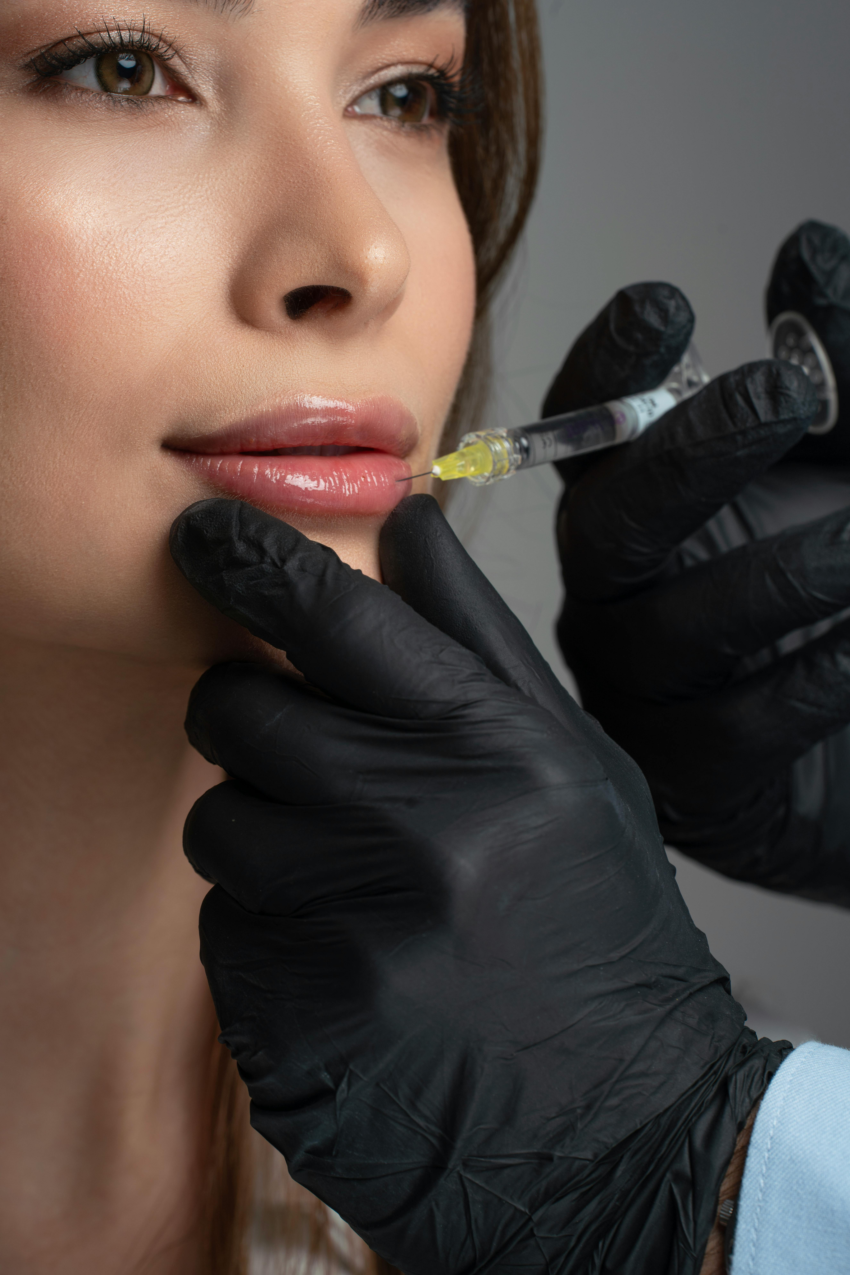 Dermal Fillers